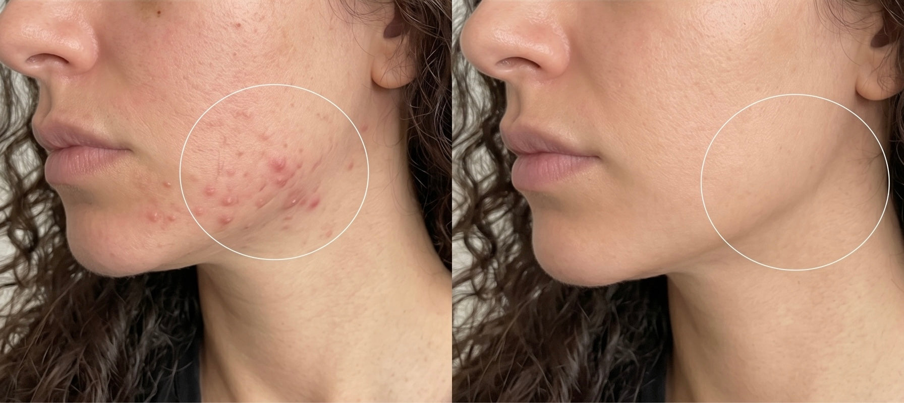 Avant et après — imperfections apaisées